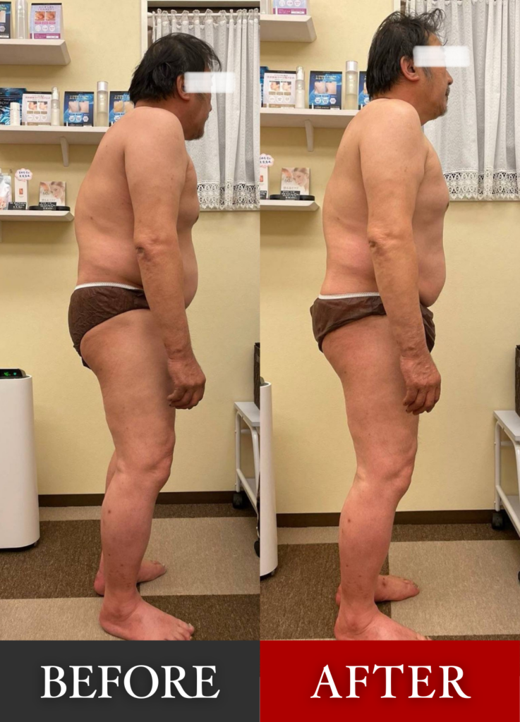 60代、自営業、男性
脊柱管狭窄症
脊柱にボルトが3本入っている
どこに行っても良くならなかったが
ハンドセラピスをすると背筋が伸びて楽になる
初めは週に一度の来店だったが
今では身体が柔らかくなり筋肉の硬直もなり
初回来店時から3年目
1ヶ月に一度の施術になっている。